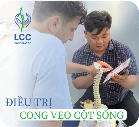 Cong Vẹo Cột Sống