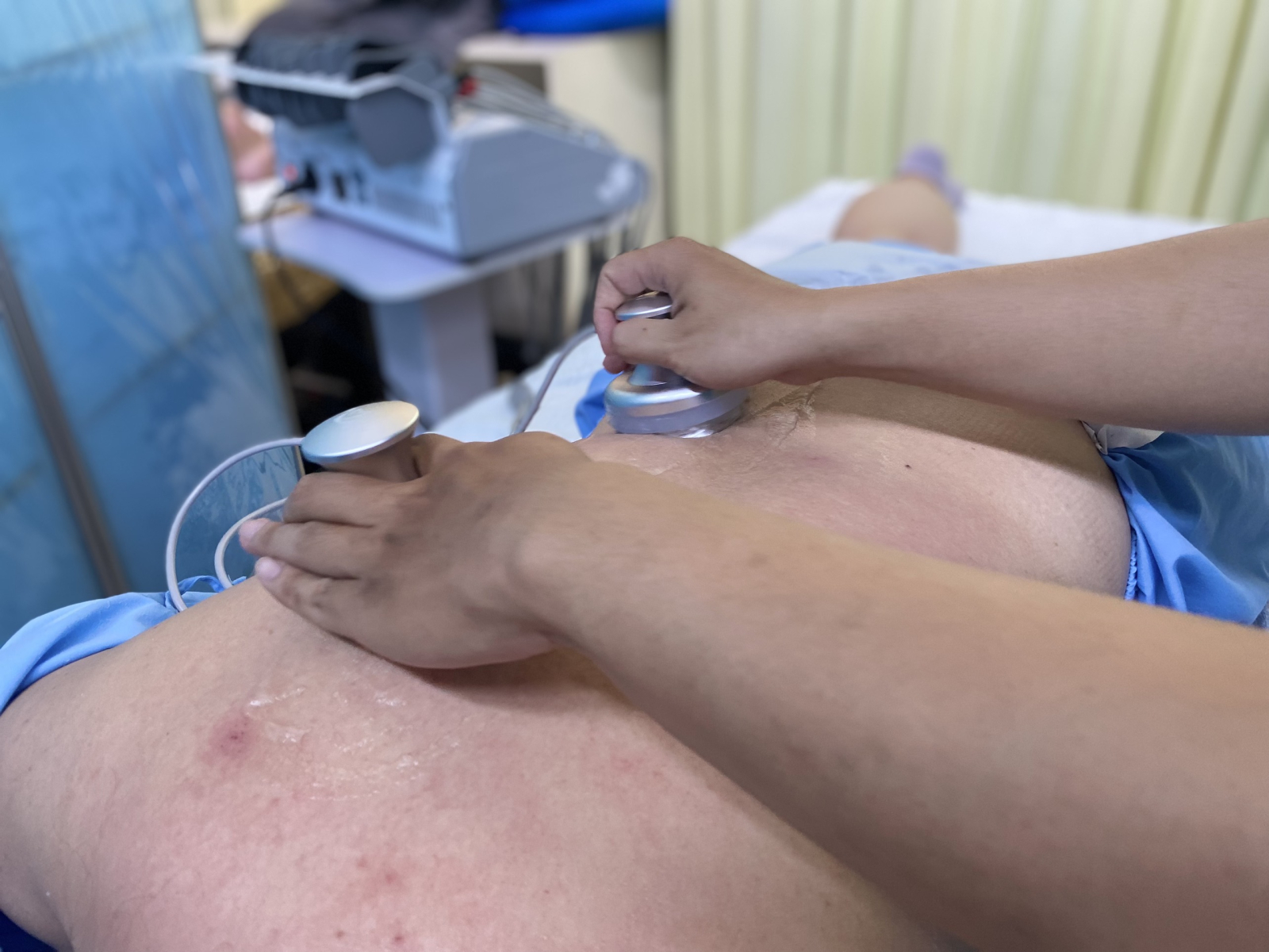 Điều trị đau thắt co liên sườn tại LCC Chiropractic