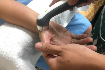 Tê Tay Do Chèn Ép Rễ Thần Kinh