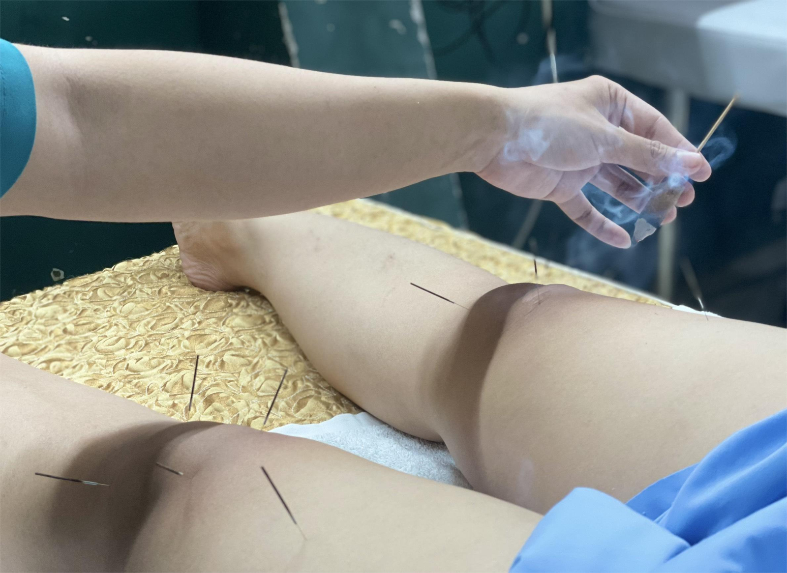 Điều trị Tràn dịch khớp gối tại LCC Chiropactic